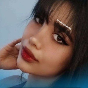 rhinoplasty-12