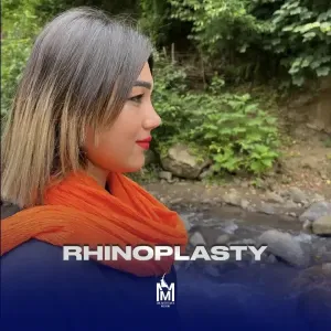 rhinoplasty-19