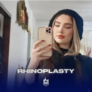 rhinoplasty-20