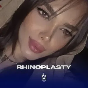 rhinoplasty-22