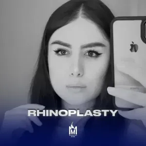 rhinoplasty-24