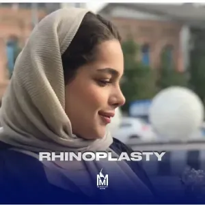 rhinoplasty-26