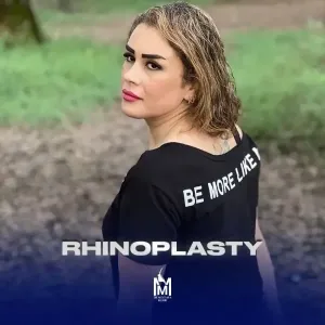rhinoplasty-32