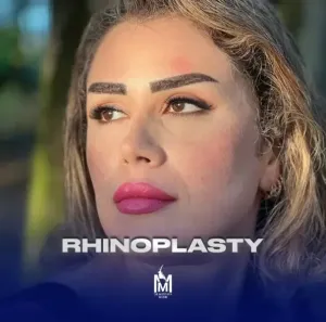 rhinoplasty-33