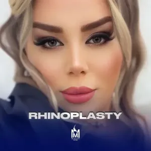 rhinoplasty-38