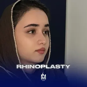 rhinoplasty-42