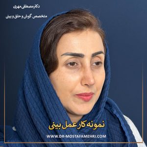 جراحیبینی استخوانی _ دکتر مصطفی مهری