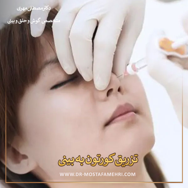 تزریق کورتون به بینی در رشت _ دکتر مصطفی مهری