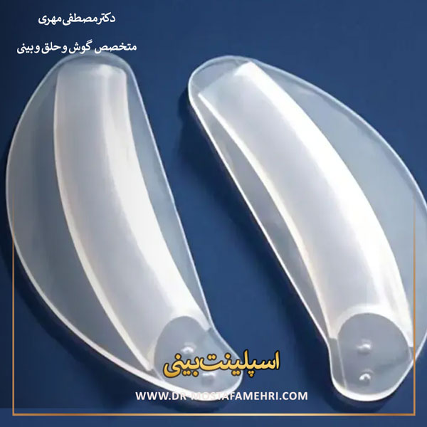 اسپلینت یبنی _ دکتر مصطفی مهری