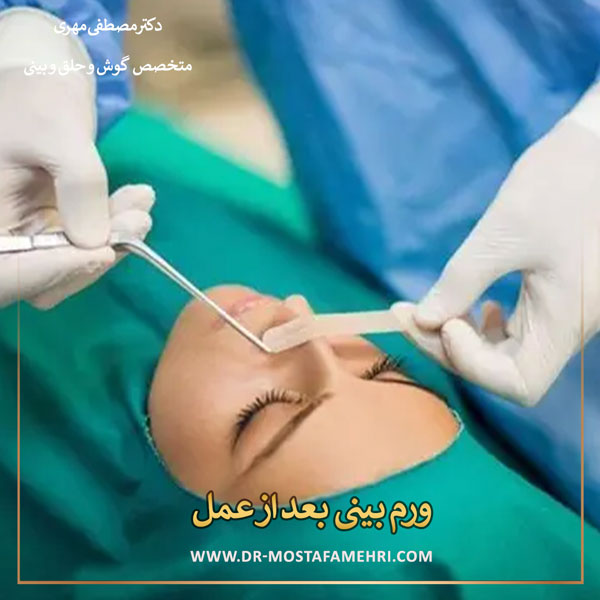 ورم بینی بعد از عمل _ دکتر مصطفی مهری