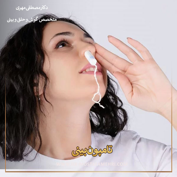 تامپون بینی _ دکتر مصطفی مهری