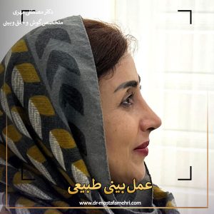 عکس بینی طبیعی عمل شده