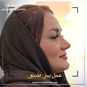 عکس بینی طبیعی عمل شده