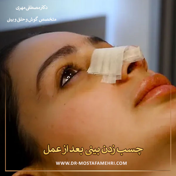 چسب زدن بینی بعد از عمل _ دکتر مصطفی مهری