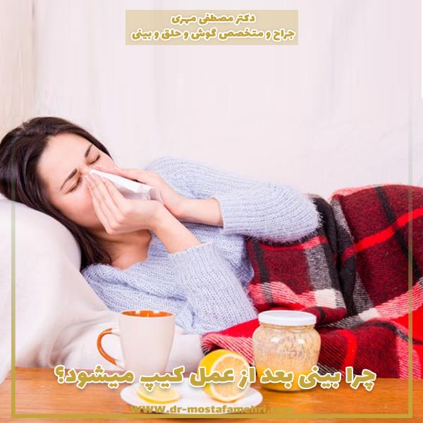 چرا بینی بعد از عمل کیپ میشود؟ درمان گرفتگی بینی بعد از عمل